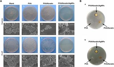 A Nano-Silver Loaded PVA/Keratin Hydrogel With Strong Mechanical Properties Provides Excellent Antibacterial Effect for Delayed Sternal Closure